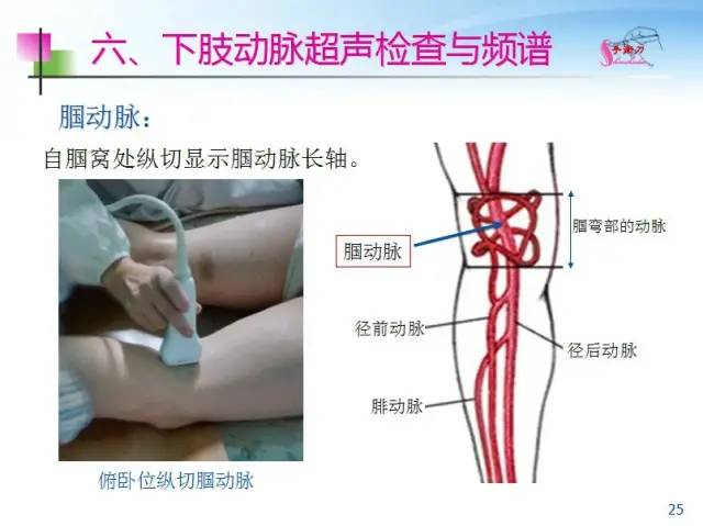 超声下肢血管解剖图谱图片